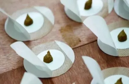 广州中医药大学金沙洲医院开展“三伏天灸”活动