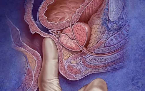 【预约】陪你走在健康“前列”,免费领取前列腺癌筛查名额!