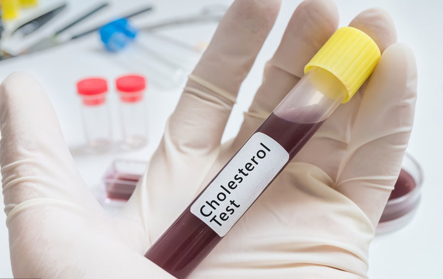 肾癌是什么原因引起的?肿瘤专家胡群峰提醒:这6种表现可能是肾癌早期征兆